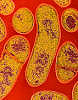 Clostridium botulinum, bacteria ce produce toxina botulinica